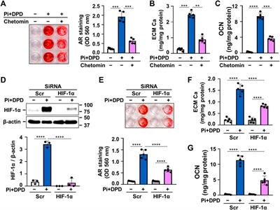 Daprodustat Accelerates High Phosphate-Induced Calcification Through the Activation of HIF-1 Signaling